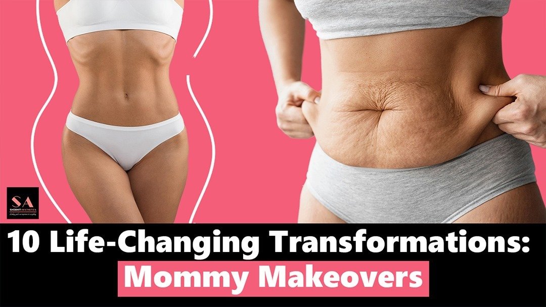 10 Life-Changing Transformations: Mommy Makeovers