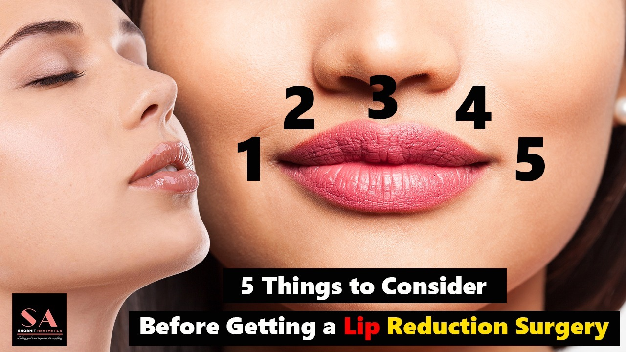 5 Things to Consider Before Getting a Lip Reduction Surgery