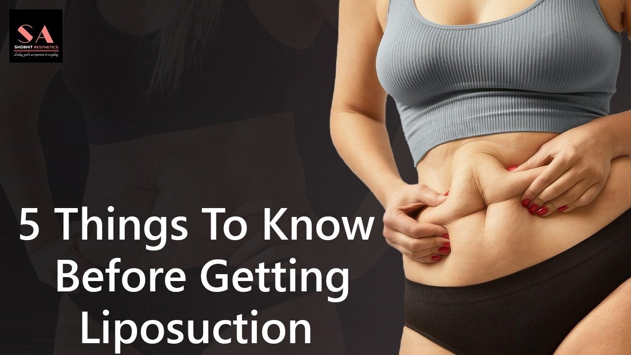 5 Things To Know Before Getting Liposuction