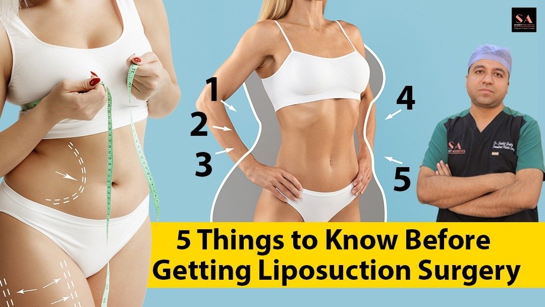 5 Things to Know Before Getting Liposuction Surgery