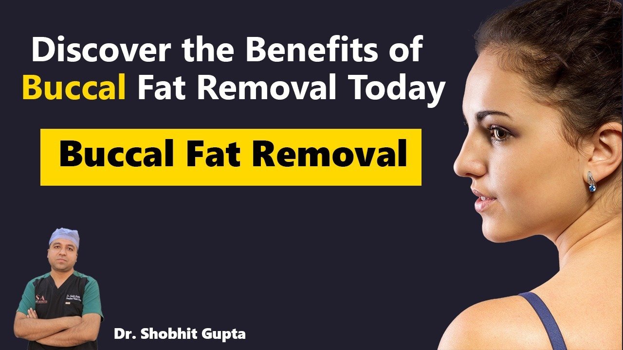 Discover the Benefits of Buccal Fat Removal Today