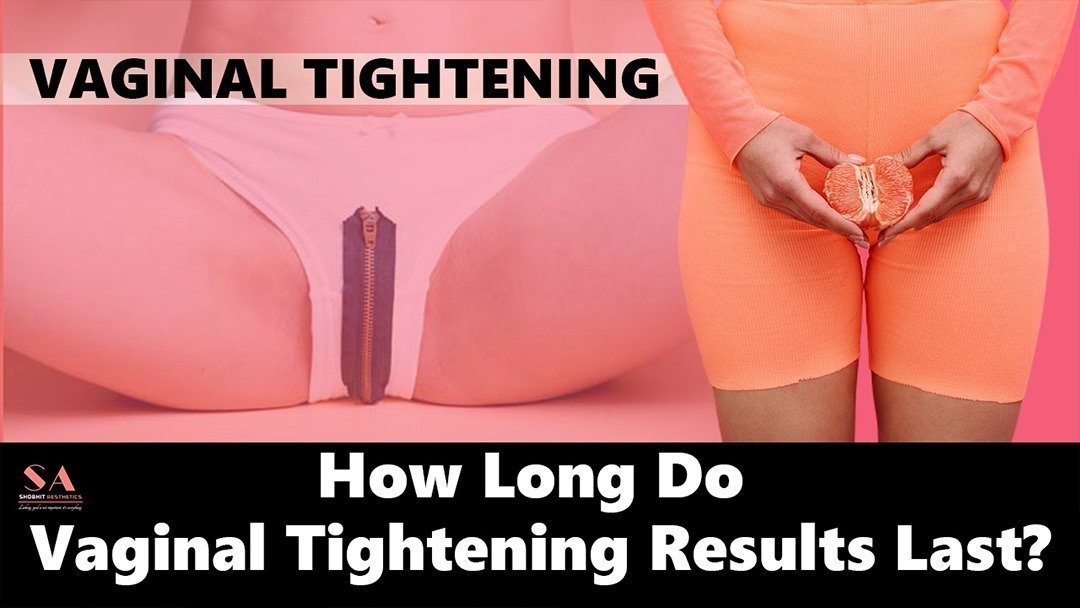 How Long Do Vaginal Tightening Results Last?